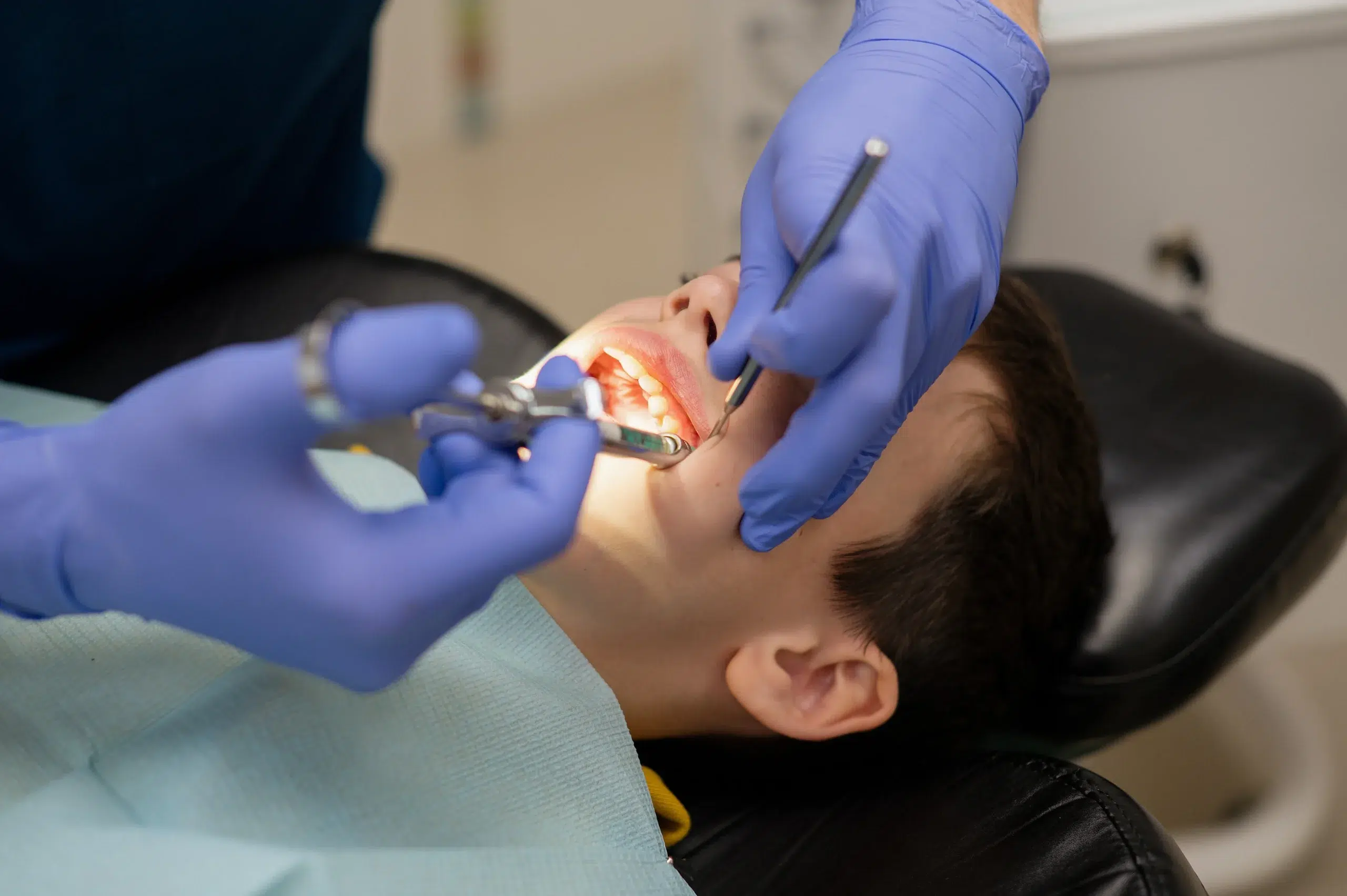 Wisdom Tooth Removal Sydney