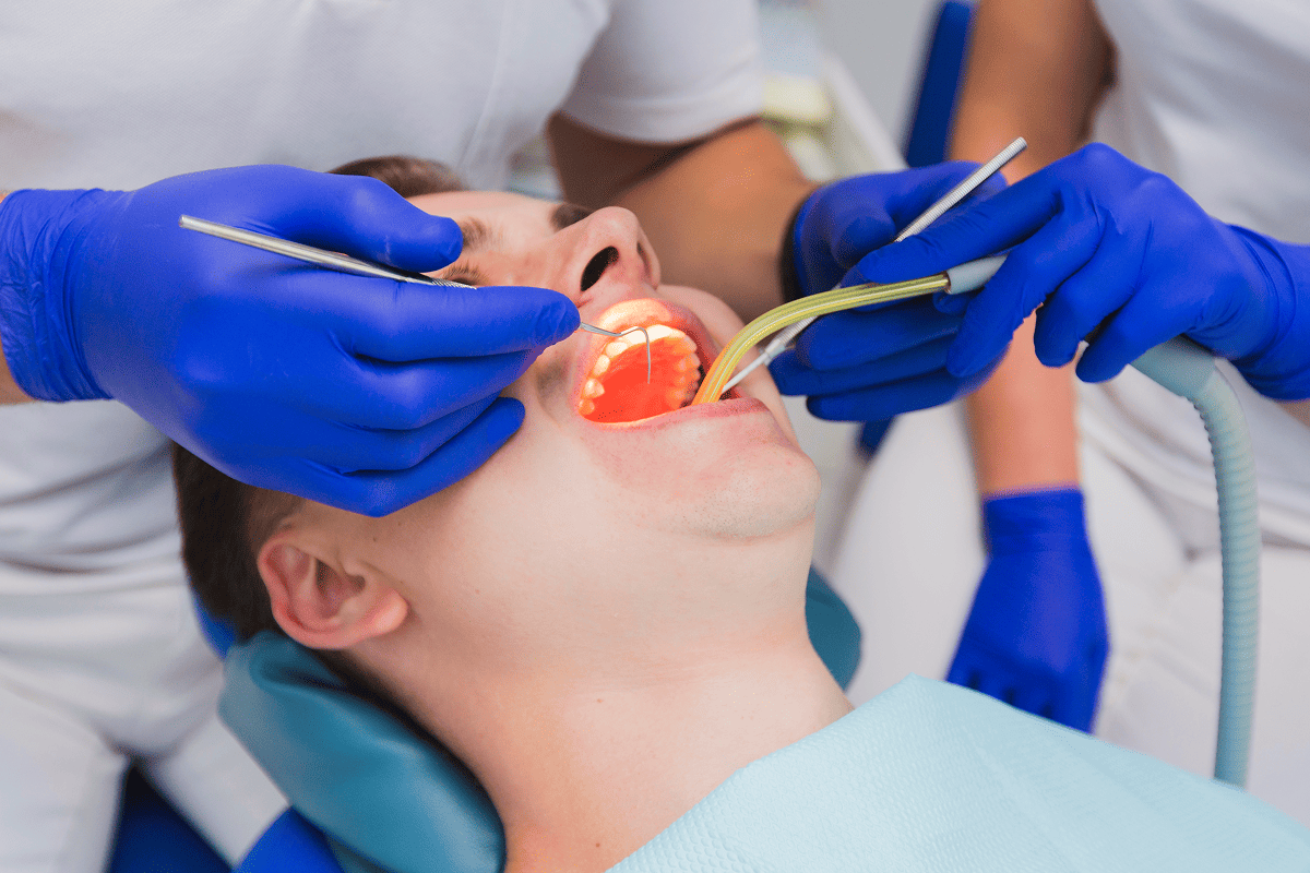Root Canal Treatments